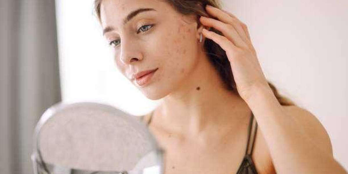 Pigmentation Treatments at House of Aesthetics Rediscover Radiant Skin