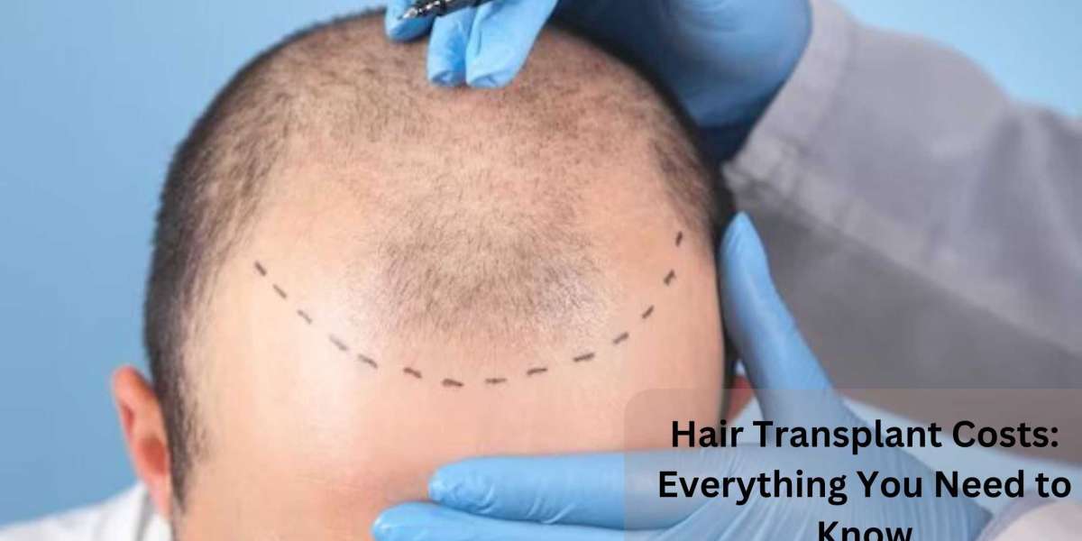 Innovative Non-Surgical Hair Restoration Treatments